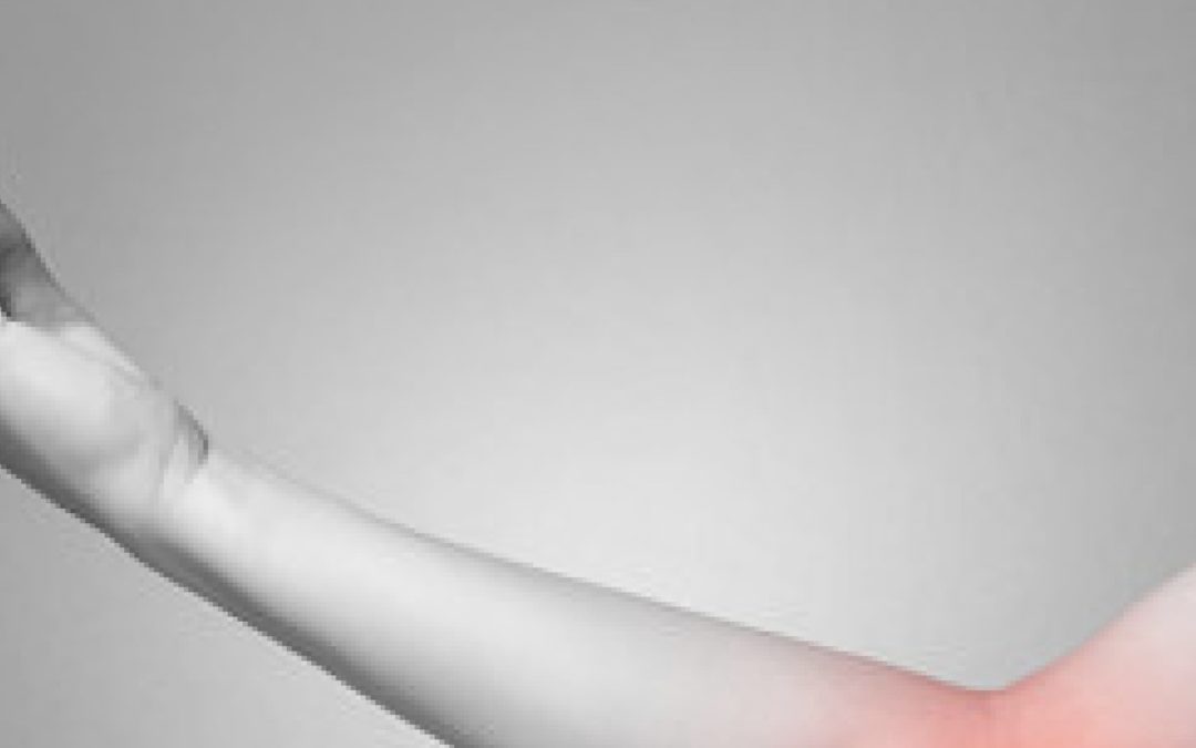 Our Top Tips To Beat Elbow Pain